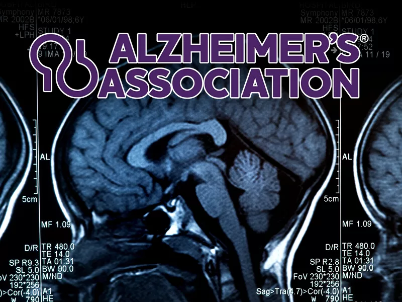 Alzheimer&#039;s Association logo over an MRI brain scan